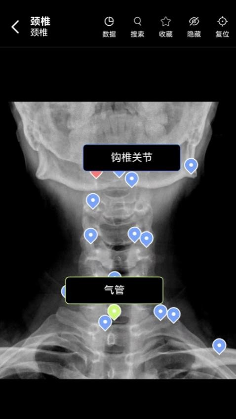 轻盈医学图谱app免费版下载