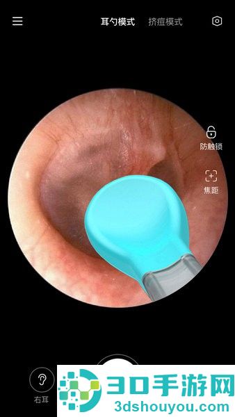 xlife掏耳勺app下载