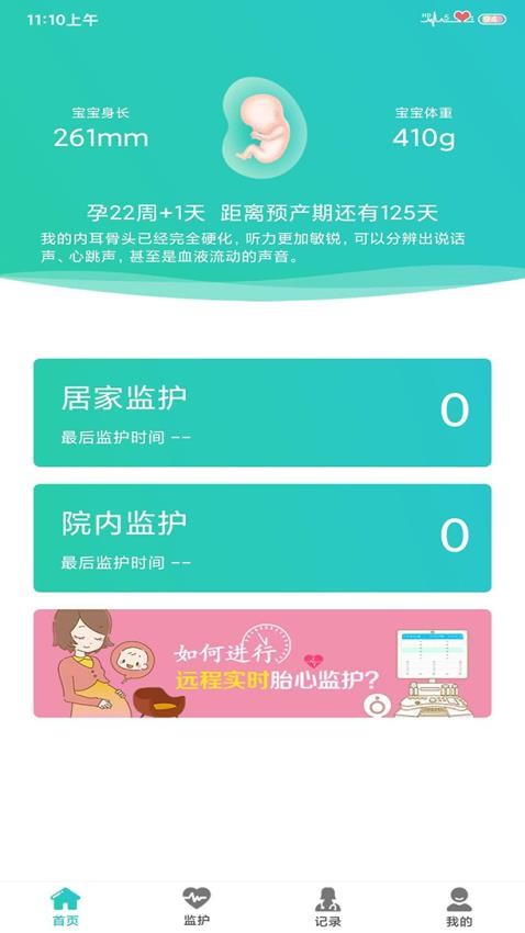 胎心监护软件下载